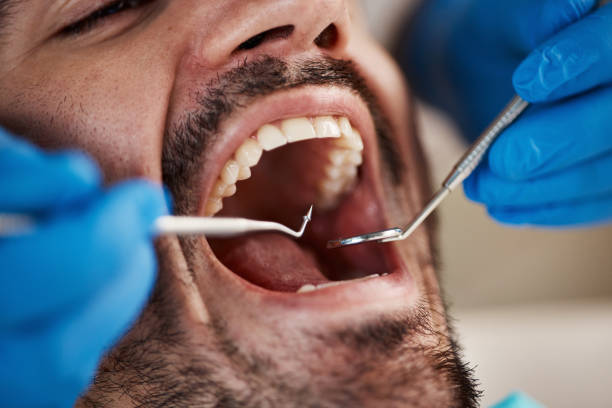 Best Emergency Dental Filling Replacement  in The Dalles, OR